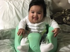 加州夫妇不听劝告生下畸形婴儿 生下畸形儿才不后悔